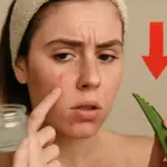 Devo usare il gelo d’aloe su pelle grassa? L’errore comune che peggiora i brufoli