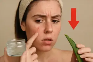 Devo usare il gelo d’aloe su pelle grassa? L’errore comune che peggiora i brufoli